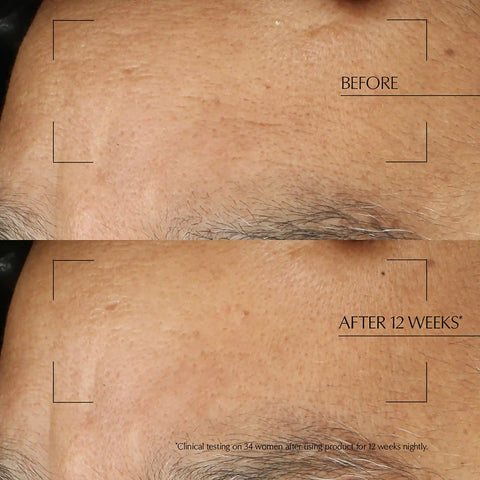 Advanced Night Repair Overnight Treatment