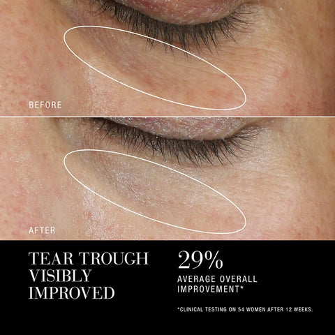Re-Nutriv Ultimate Diamond Age Reversal | Skin Longevity Eye Cream