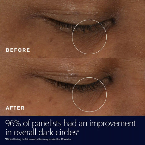 Advanced Night Repair Eye Supercharged Gel-Creme Synchronized Multi-Recovery Eye Cream - 0.5 oz.