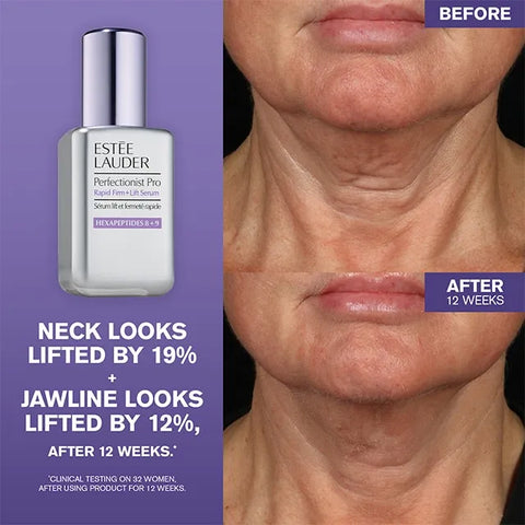 Perfectionist Pro Rapid Firm + Lift Serum with Hexapeptides 8 + 9 - 1.0 oz.