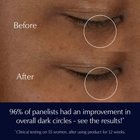 Advanced Night Repair Eye Supercharged Gel-Creme Synchronized Multi-Recovery Eye Cream - 0.5 oz.
